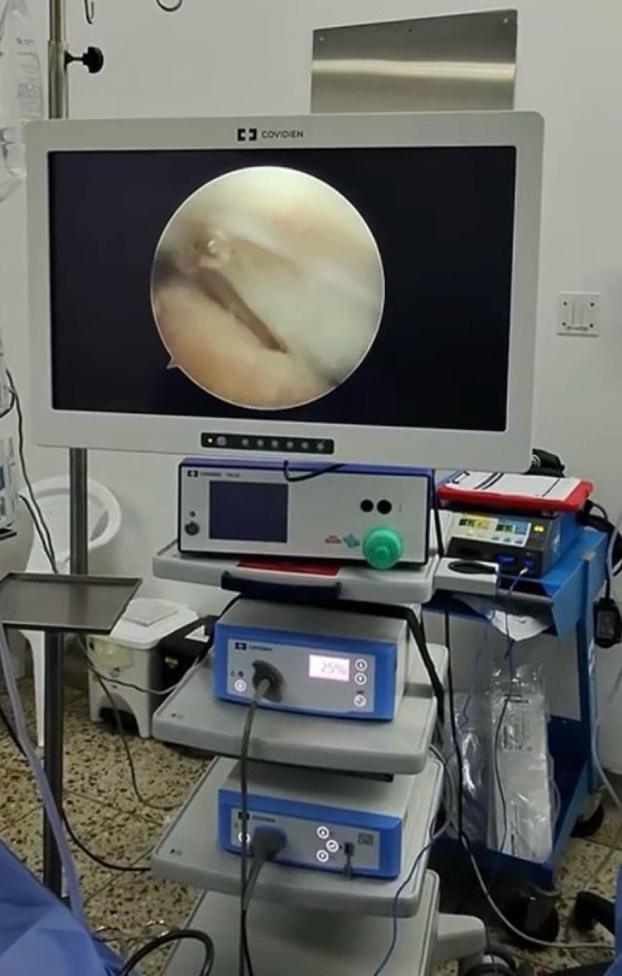 Cirugía artroscópica de rodilla en tiempo real